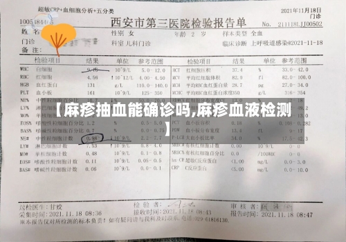 【麻疹抽血能确诊吗,麻疹血液检测】-第3张图片