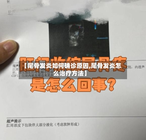 【尾骨发炎如何确诊原因,尾骨发炎怎么治疗方法】-第2张图片
