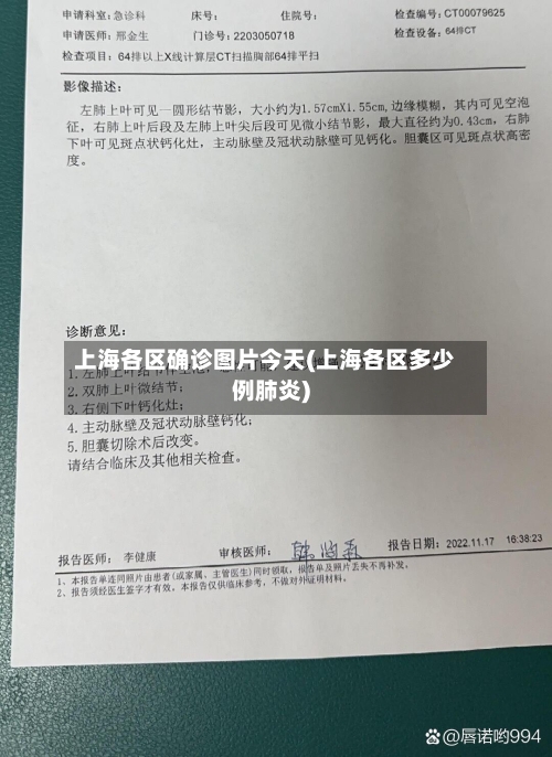 上海各区确诊图片今天(上海各区多少例肺炎)