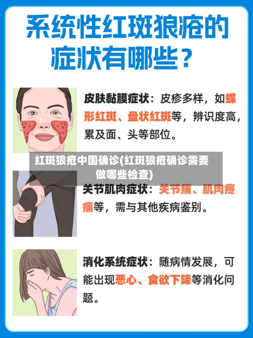 红斑狼疮中国确诊(红斑狼疮确诊需要做哪些检查)-第2张图片