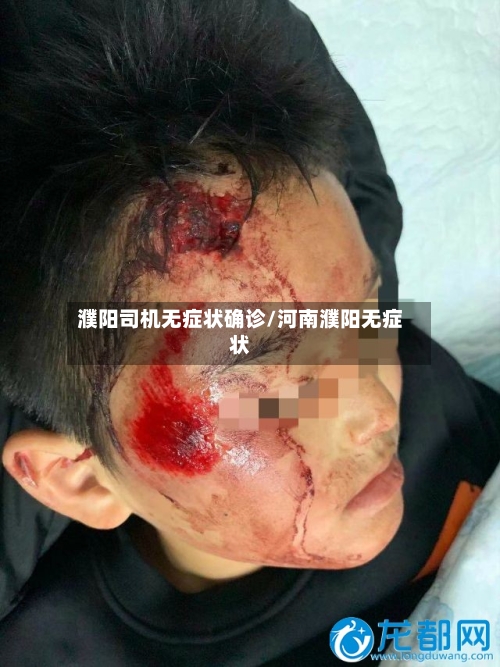濮阳司机无症状确诊/河南濮阳无症状-第3张图片