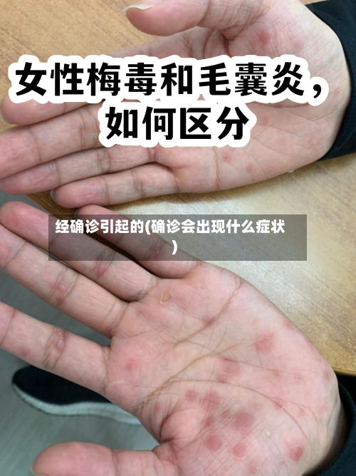 经确诊引起的(确诊会出现什么症状)-第2张图片