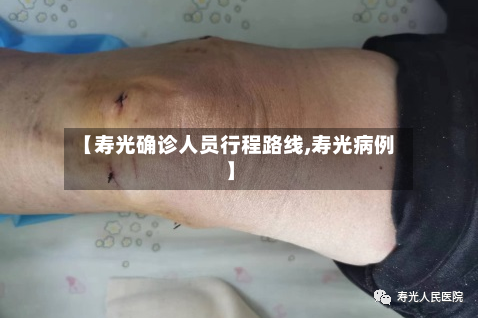 【寿光确诊人员行程路线,寿光病例】-第3张图片