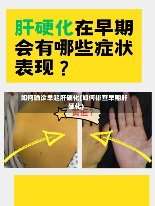 如何确诊早起肝硬化(如何排查早期肝硬化)