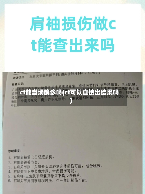 ct能当场确诊吗(ct可以直接出结果吗)