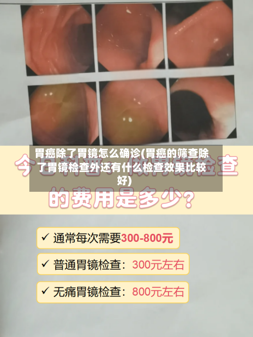 胃癌除了胃镜怎么确诊(胃癌的筛查除了胃镜检查外还有什么检查效果比较好)-第2张图片