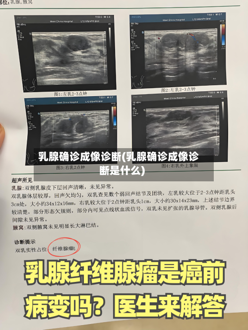 乳腺确诊成像诊断(乳腺确诊成像诊断是什么)