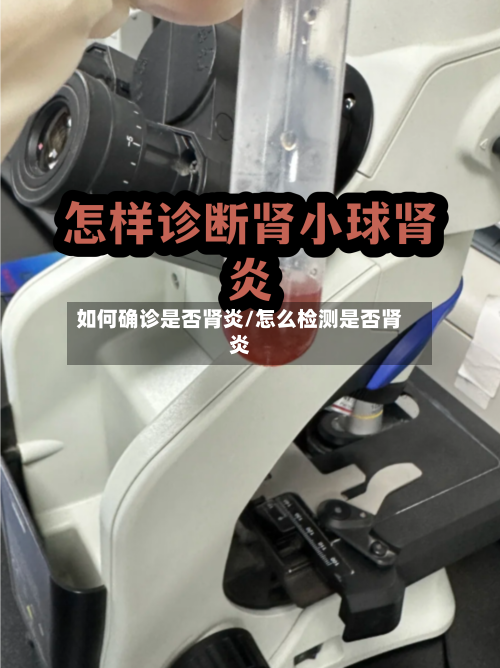 如何确诊是否肾炎/怎么检测是否肾炎-第3张图片
