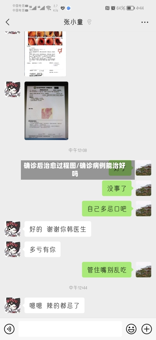 确诊后治愈过程图/确诊病例能治好吗-第2张图片