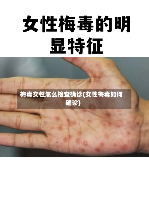 梅毒女性怎么检查确诊(女性梅毒如何确诊)