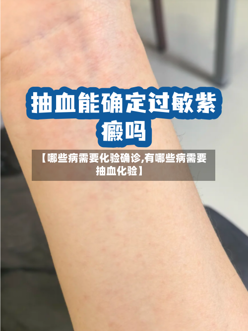 【哪些病需要化验确诊,有哪些病需要抽血化验】-第3张图片