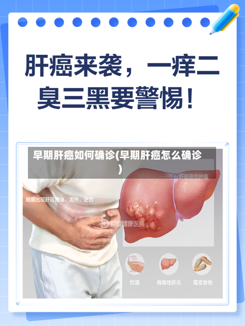 早期肝癌如何确诊(早期肝癌怎么确诊)-第2张图片