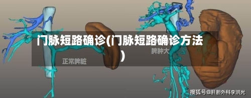 门脉短路确诊(门脉短路确诊方法)