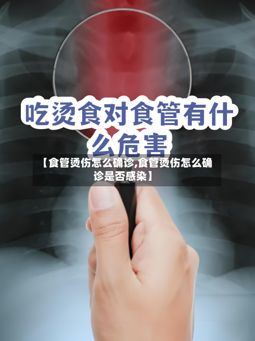 【食管烫伤怎么确诊,食管烫伤怎么确诊是否感染】