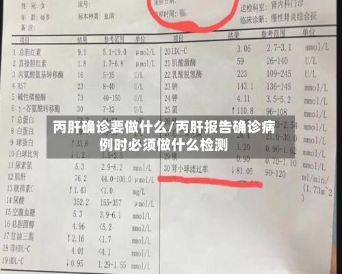 丙肝确诊要做什么/丙肝报告确诊病例时必须做什么检测