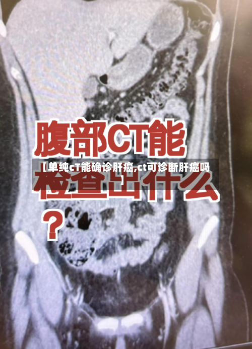 【单纯cT能确诊肝癌,ct可诊断肝癌吗】-第2张图片