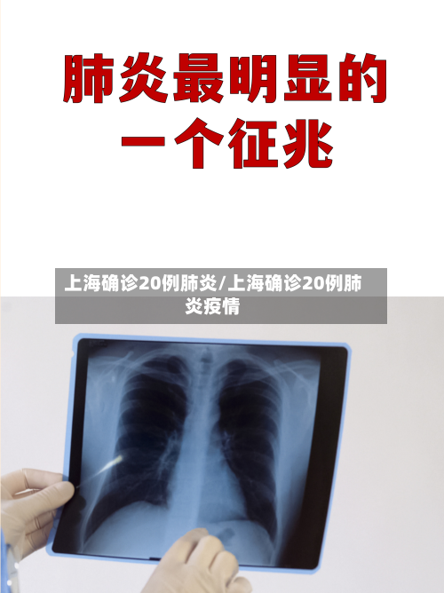 上海确诊20例肺炎/上海确诊20例肺炎疫情-第3张图片