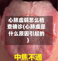 心肺虚弱怎么检查确诊(心肺虚是什么原因引起的)