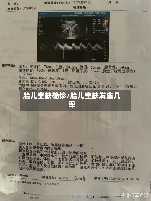 胎儿室缺确诊/胎儿室缺发生几率