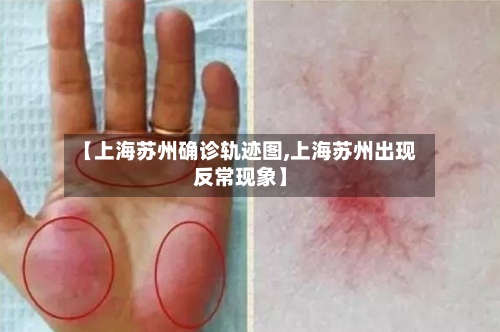 【上海苏州确诊轨迹图,上海苏州出现反常现象】