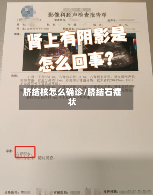 脐结核怎么确诊/脐结石症状