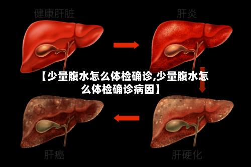 【少量腹水怎么体检确诊,少量腹水怎么体检确诊病因】-第2张图片
