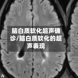 脑白质软化超声确诊/脑白质软化的超声表现-第2张图片