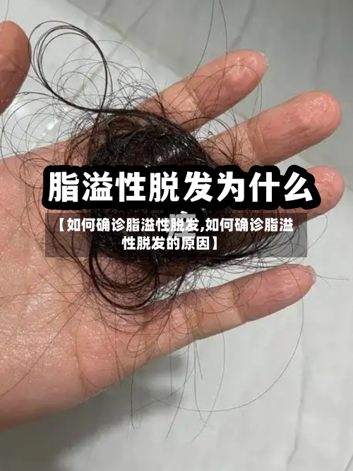 【如何确诊脂溢性脱发,如何确诊脂溢性脱发的原因】-第3张图片