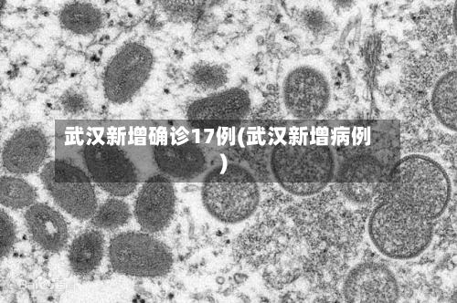 武汉新增确诊17例(武汉新增病例)-第2张图片