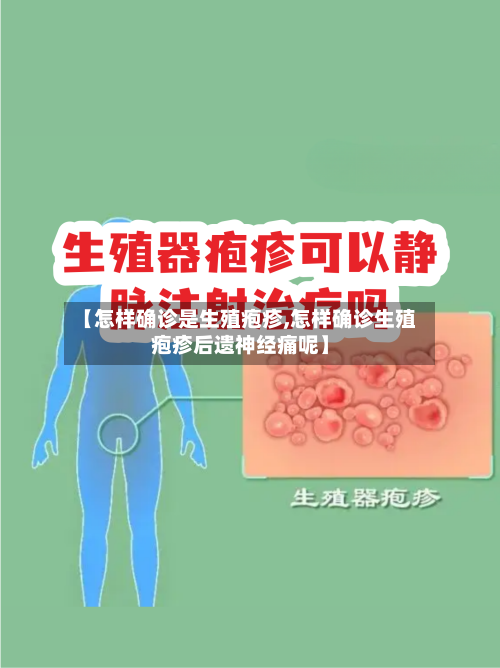 【怎样确诊是生殖疱疹,怎样确诊生殖疱疹后遗神经痛呢】-第2张图片