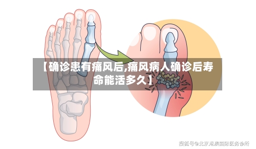 【确诊患有痛风后,痛风病人确诊后寿命能活多久】