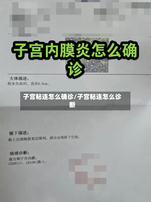 子宫粘连怎么确诊/子宫粘连怎么诊断