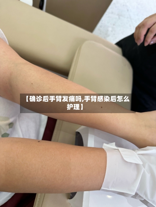 【确诊后手臂发痛吗,手臂感染后怎么护理】-第2张图片