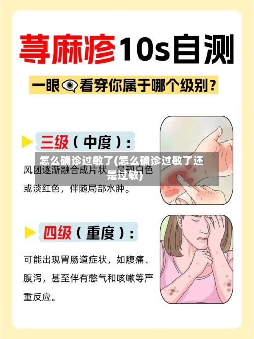 怎么确诊过敏了(怎么确诊过敏了还是过敏)-第3张图片