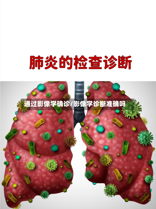 通过影像学确诊/影像学诊断准确吗-第3张图片