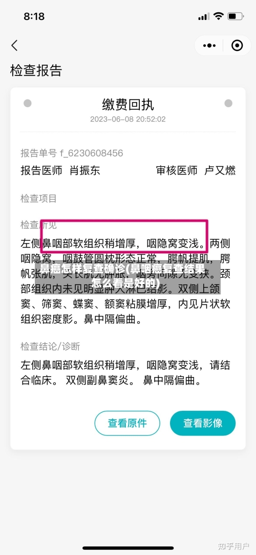 鼻癌怎样复查确诊(鼻咽癌复查结果怎么看是好的)