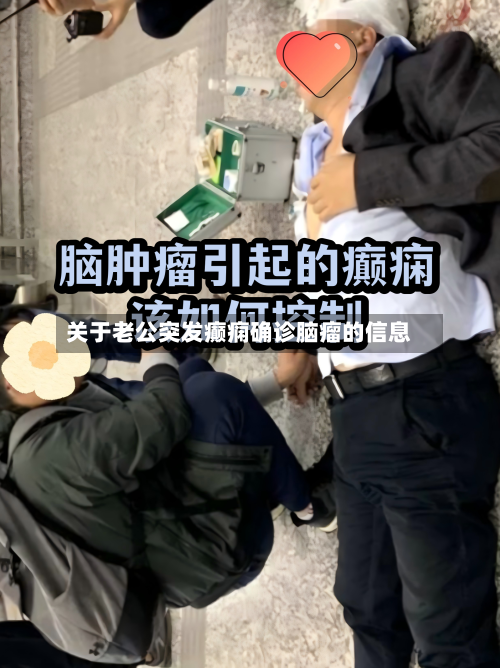 关于老公突发癫痫确诊脑瘤的信息