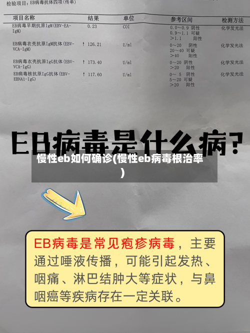 慢性eb如何确诊(慢性eb病毒根治率)