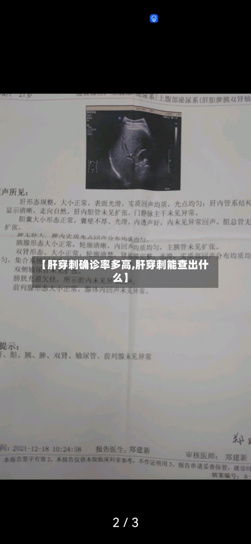 【肝穿刺确诊率多高,肝穿刺能查出什么】