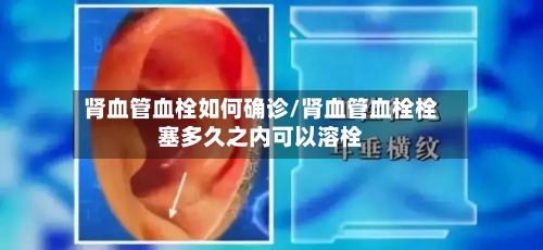 肾血管血栓如何确诊/肾血管血栓栓塞多久之内可以溶栓-第2张图片
