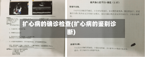 扩心病的确诊检查(扩心病的鉴别诊断)