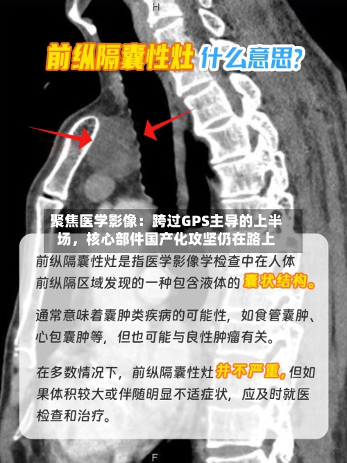 聚焦医学影像：跨过GPS主导的上半场，核心部件国产化攻坚仍在路上-第2张图片