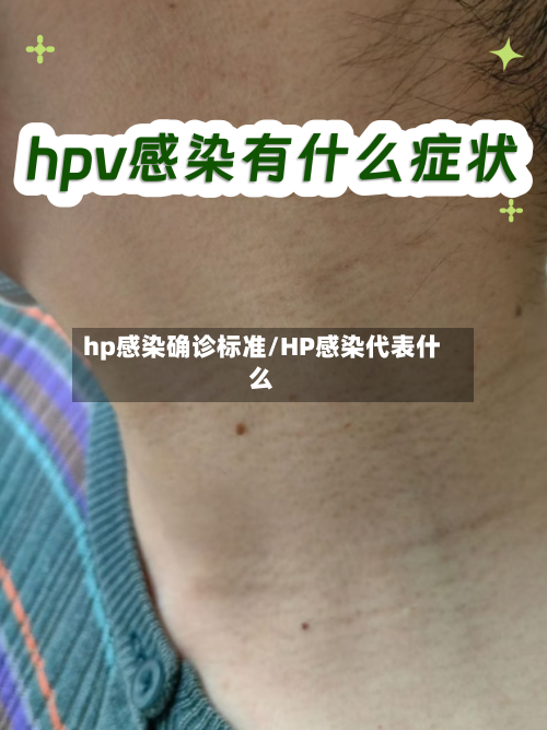hp感染确诊标准/HP感染代表什么-第3张图片