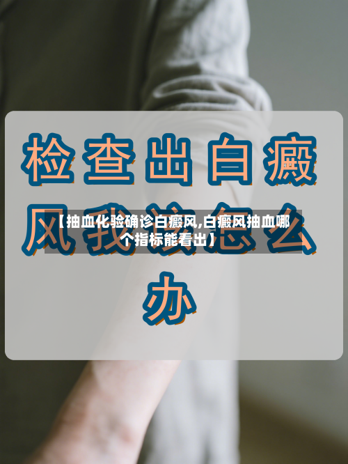 【抽血化验确诊白癜风,白癜风抽血哪个指标能看出】
