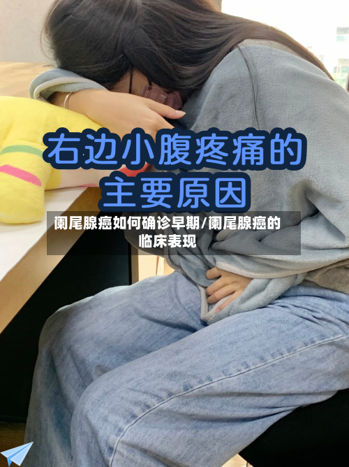阑尾腺癌如何确诊早期/阑尾腺癌的临床表现