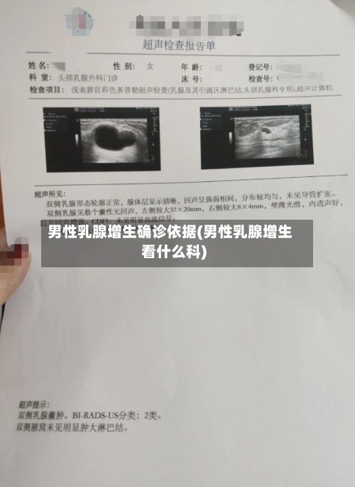 男性乳腺增生确诊依据(男性乳腺增生看什么科)-第3张图片