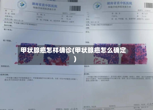 甲状腺癌怎样确诊(甲状腺癌怎么确定)-第3张图片