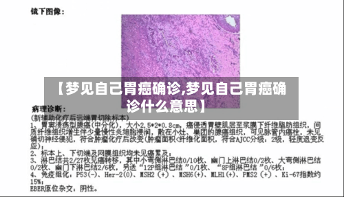 【梦见自己胃癌确诊,梦见自己胃癌确诊什么意思】-第3张图片