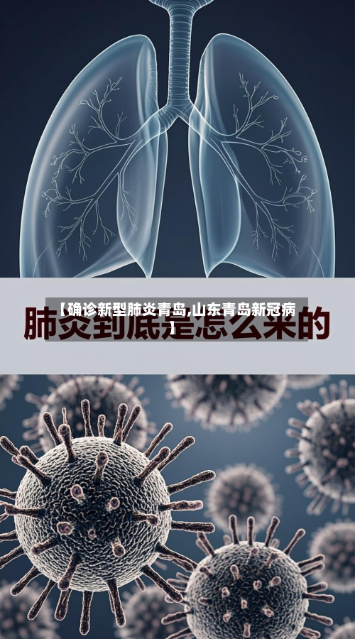 【确诊新型肺炎青岛,山东青岛新冠病】-第2张图片