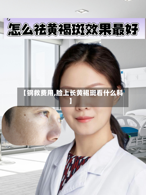 【钢救费用,脸上长黄褐斑看什么科】